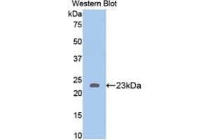 Western blot analysis of the recombinant protein. (Thrombospondin 1 抗体  (AA 71-259))