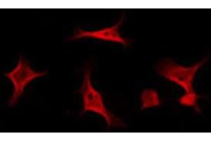 ABIN6267559 staining NIH-3T3 by IF/ICC. (BCAR1 抗体  (pTyr410))