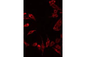ABIN6276023 staining LOVO by IF/ICC. (GPR180 抗体  (Internal Region))