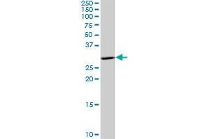 HSD17B12 polyclonal antibody (A01), Lot # 060803QCS1. (HSD17B12 抗体  (AA 203-271))