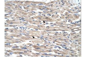 Immunohistochemistry (IHC) image for anti-BMP2 Inducible Kinase (BMP2K) (C-Term) antibody (ABIN2775440) (BMP2K 抗体  (C-Term))