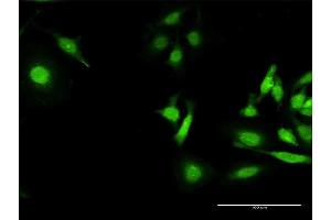 Immunofluorescence of purified MaxPab antibody to HLA-A on HeLa cell. (HLA-A 抗体  (AA 1-365))