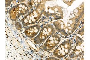 Phospho-TAO2 (Ser181) Antibody at 1/100 staining Rat colorectal tissue by IHC-P. (TAO Kinase 2 抗体  (pSer181))