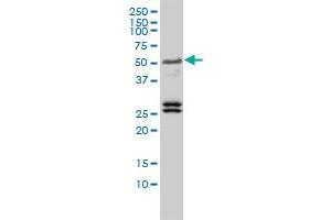 TFEB monoclonal antibody (M01), clone 3E1-G6 Western Blot analysis of TFEB expression in Jurkat (TFEB 抗体  (AA 1-476))