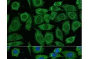 Immunofluorescence analysis of L929 cells using DLAT Polyclonal Antibody at dilution of 1:100.