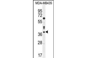 CASP3 Antibody (C-term) (ABIN655271 and ABIN2844863) western blot analysis in MDA-M cell line lysates (35 μg/lane). (Caspase 3 抗体  (C-Term))