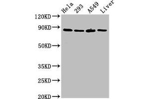 Western Blot Positive WB detected in: Hela whole cell lysate, 293 whole cell lysate, A549 whole cell lysate, Rat liver tissue All lanes: USP10 antibody at 3 μg/mL Secondary Goat polyclonal to rabbit IgG at 1/50000 dilution Predicted band size: 88, 93 kDa Observed band size: 88 kDa (USP1 抗体  (AA 453-592))
