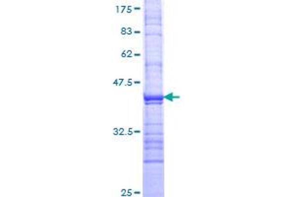 GRIK1 Protein (AA 331-440) (GST tag)