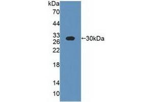 Detection of Recombinant CSN1, Bovine using Polyclonal Antibody to Casein Alpha (CSN1) (Casein alpha S1 抗体  (AA 16-187))