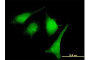 Immunofluorescence of purified MaxPab rabbit antibody to MAP2K2 on HeLa cell. (MEK2 抗体  (AA 1-400))