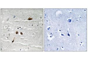 Immunohistochemistry analysis of paraffin-embedded human brain tissue using MDC1 (Phospho-Ser513) antibody. (MDC1 抗体  (pSer513))