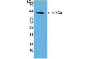 Western blot analysis of recombinant Human C4a. (C4A 抗体  (AA 680-756))