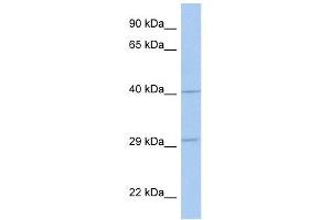 ART5 antibody used at 1 ug/ml to detect target protein. (ART5 抗体  (Middle Region))