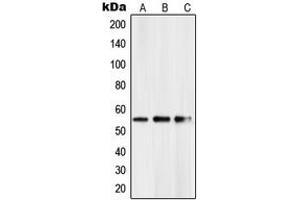 Western blot analysis of PKNOX2 expression in HeLa (A), mouse kidney (B), rat kidney (C) whole cell lysates. (PKNOX2 抗体  (C-Term))