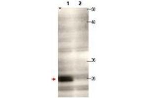 Image no. 1 for anti-Centromere Protein Q (CENPQ) antibody (ABIN1100754) (CENPQ 抗体)
