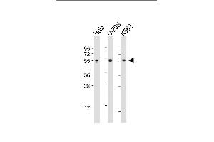 All lanes : Anti-AIRE Antibody (Center) at 1:2000 dilution Lane 1: Hela whole cell lysate Lane 2: U-20S whole cell lysate Lane 3: K562 whole cell lysate Lysates/proteins at 20 μg per lane. (AIRE 抗体  (AA 64-92))