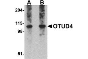 Western Blotting (WB) image for anti-OTU Domain Containing 4 (OTUD4) (C-Term) antibody (ABIN1030565) (OTUD4 抗体  (C-Term))