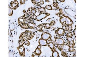 IHC analysis of TIP49A/RUVBL1 using anti-TIP49A/RUVBL1 antibody (ABIN7599928). (RUVBL1 抗体  (AA 13-23))