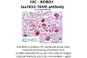 Image no. 1 for anti-Roundabout, Axon Guidance Receptor, Homolog 1 (ROBO1) (AA 1632-1644) antibody (ABIN1738905) (ROBO1 抗体  (AA 1632-1644))
