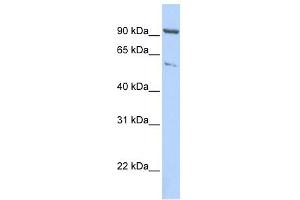 WB Suggested Anti-KIF2A Antibody Titration:  0. (KIF2A 抗体  (C-Term))