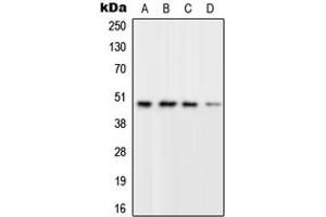 Western blot analysis of RPL3 expression in A549 (A), SP2/0 (B), PC12 (C), Human brain (D) whole cell lysates.