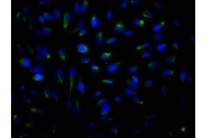 Immunofluorescence staining of Hela Cells with ABIN7127797 at 1:50, counter-stained with DAPI. (Recombinant ROCK2 抗体)