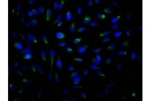 Immunofluorescence staining of Hela Cells with ABIN7127797 at 1:50, counter-stained with DAPI. (Recombinant ROCK2 抗体)