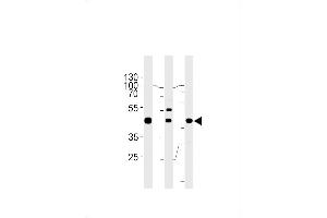 Western blot analysis in A549,K562,MCF-7 cell line lysates (35ug/lane).
