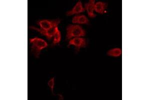 ABIN6267685 staining MDA-MB-435 by IF/ICC. (ASK1 抗体  (pSer83))