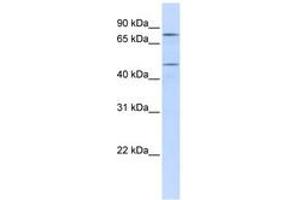 Image no. 1 for anti-Excision Repair Cross-Complementing Rodent Repair Deficiency, Complementation Group 8 (ERCC8) (AA 72-121) antibody (ABIN6741407)