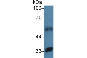 Western Blot; Sample: Human Lung lysate; Primary Ab: 3µg/ml Rabbit Anti-Human FBLN4 Antibody Second Ab: 0. (FBLN4 抗体  (AA 17-169))