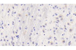 Immunohistochemistry (IHC) image for anti-Fibrinogen gamma Chain (FGG) (AA 168-405) antibody (ABIN7437560)
