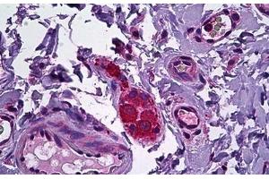 Human Intestine, Ganglion Cells: Formalin-Fixed, Paraffin-Embedded (FFPE) (NPY5R 抗体  (AA 241-252))