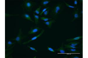 Immunofluorescence of purified MaxPab antibody to PPID on HeLa cell.