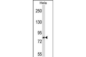 Western blot analysis in Hela cell line lysates (35ug/lane). (TRIM37 抗体  (C-Term))
