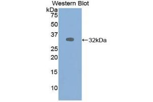 Detection of Recombinant ALDOA, Human using Polyclonal Antibody to Aldolase A, Fructose Bisphosphate (ALDOA) (ALDOA 抗体  (AA 18-273))