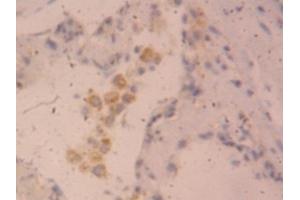 Detection of CLCF1 in Human Lung Tissue using Polyclonal Antibody to Cardiotrophin Like Cytokine Factor 1 (CLCF1) (CLCF1 抗体  (AA 88-190))