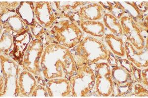 Immunohistochemistry of paraffin-embedded Human kidney using FGB Polycloanl Antibody at dilution of 1:200 (Fibrinogen beta Chain 抗体)