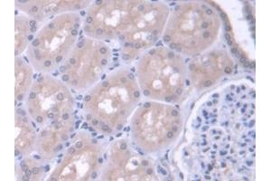 Detection of FARS2 in Human Kidney Tissue using Polyclonal Antibody to Phenylalanyl tRNA Synthetase 2, Mitochondrial (FARS2) (FARS2 抗体  (AA 1-451))