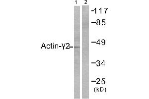 Western blot analysis of extracts from COLO205 cells, using Actin-γ2 antibody.