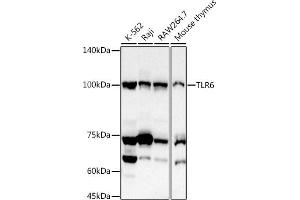 Western blot analysis of extracts of various cell lines, using TLR6 antibody (ABIN7270847) at 1:1000 dilution. (TLR6 抗体  (AA 32-200))