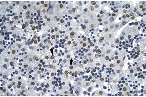Immunohistochemistry (IHC) image for anti-Apoptosis Antagonizing Transcription Factor (AATF) (N-Term) antibody (ABIN2777467)