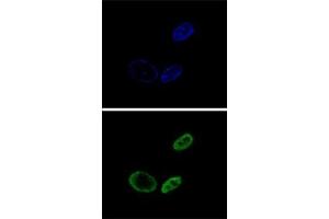 Confocal immunofluorescent analysis of NR0B2 Antibody (Center)(Cat#AP52928PU-N) with HepG2 cell followed by Alexa Fluor® 488-conjugated goat anti-rabbit lgG (green).