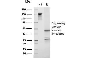 SDS-PAGE Analysis Purified Monospecific Mouse Monoclonal Antibody to Transferrin (TF/3001). (Transferrin 抗体  (AA 311-445))
