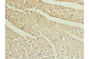 Immunohistochemistry of paraffin-embedded human heart tissue using ABIN7151077 at dilution of 1:100 (MYLIP 抗体  (AA 266-445))