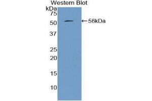 Western Blotting (WB) image for anti-Mannose-Binding Lectin (Protein C) 2, Soluble (MBL2) (AA 19-244) antibody (ABIN3210086) (MBL2 抗体  (AA 19-244))