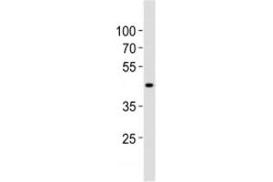 Western blot analysis of lysate from human kidney tissue lysate using SOX7 antibody diluted at 1:1000. (SOX7 抗体  (AA 224-258))