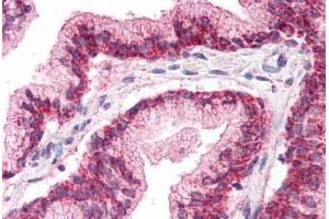 Human Prostate (formalin-fixed, paraffin-embedded) stained with LHX2 antibody ABIN337089 at 5 ug/ml followed by biotinylated goat anti-rabbit IgG secondary antibody ABIN481713, alkaline phosphatase-streptavidin and chromogen. (LHX2 抗体  (AA 239-254))