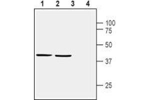 Homer Homolog 1 (HOMER1) peptide