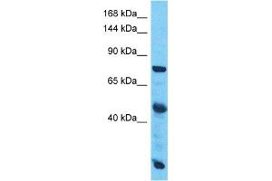 Host:  Rabbit  Target Name:  SLC38A10  Sample Type:  Esophagus Tumor lysates  Antibody Dilution:  1. (SLC38A10 抗体  (C-Term))